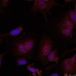 Invitrogen Phospho-JunB (Ser79) Polyclonal Antibody 100 &mu;L; Unconjugated:Antibodies,
