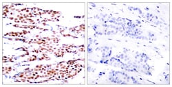 Invitrogen Phospho-JunB (Ser79) Polyclonal Antibody 100 &mu;L; Unconjugated:Antibodies,