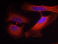 Invitrogen Phospho-Cytokeratin 8 (Ser74) Polyclonal Antibody 100 &mu;L;
