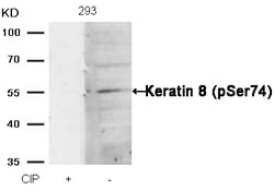 Invitrogen Phospho-Cytokeratin 8 (Ser74) Polyclonal Antibody 100 &mu;L | Buy Online | Invitrogen&trade; | Fisher Scientific
