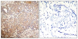 Phospho-Cytokeratin 18 (Ser33) Polyclonal Antibody:Antibodies, Polyclonal