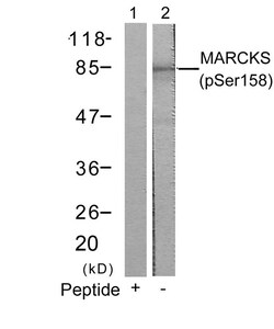 Invitrogen Phospho-MARCKS (Ser158) Polyclonal Antibody 100 &mu;L | Buy Online | Invitrogen&trade; | Fisher Scientific