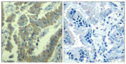 Invitrogen Phospho-MARCKS (Ser170) Polyclonal Antibody 100 &mu;L; Unconjugated:Antibodies,