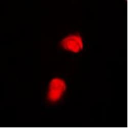 Invitrogen Phospho-SMAD2 (Thr220) Polyclonal Antibody 100 &mu;L; Unconjugated:Antibodies,