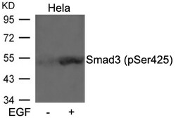 Invitrogen Phospho-SMAD3 (Ser425) Polyclonal Antibody 100 &mu;L | Buy Online | Invitrogen&trade; | Fisher Scientific