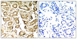 Invitrogen Phospho-MEF2A (Ser408) Polyclonal Antibody 100 μL; Unconjugated:Antibodies,