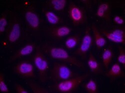 Invitrogen Phospho-MEF2A (Thr312) Polyclonal Antibody 100 &mu;L; Unconjugated:Antibodies,