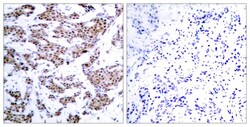 Invitrogen Phospho-MEF2A (Thr312) Polyclonal Antibody 100 &mu;L; Unconjugated:Antibodies,