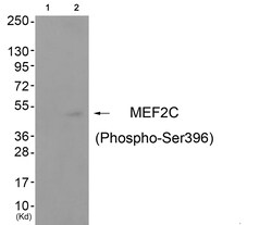 Invitrogen Phospho-MEF2C (Ser396) Polyclonal Antibody 100 &mu;L | Buy Online | Invitrogen&trade; | Fisher Scientific