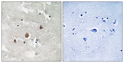Invitrogen Phospho-MEKK1 (Thr1402) Polyclonal Antibody 100 &mu;L; Unconjugated:Antibodies,
