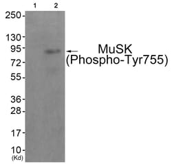 Invitrogen Phospho-MUSK (Tyr755) Polyclonal Antibody 100 &mu;L; Unconjugated:Antibodies,