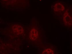 Phospho-c-Myc (Ser62) Polyclonal Antibody:Antibodies, Polyclonal