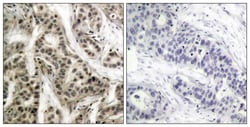 Invitrogen Phospho-NFkB p105/p50 (Ser337) Polyclonal Antibody 100 &mu;L;