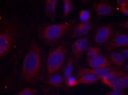 Invitrogen Phospho-NFkB p105 (Ser893) Polyclonal Antibody 100 &mu;L; Unconjugated:Antibodies,