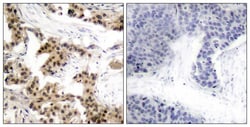 Invitrogen Phospho-NFkB p105 (Ser893) Polyclonal Antibody 100 &mu;L; Unconjugated:Antibodies,
