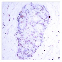 Invitrogen Phospho-NFkB p105 (Ser907) Polyclonal Antibody 100 &mu;L; Unconjugated:Antibodies,