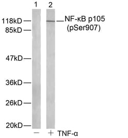 Invitrogen Phospho-NFkB p105 (Ser907) Polyclonal Antibody 100 &mu;L | Buy Online | Invitrogen&trade; | Fisher Scientific