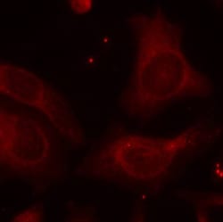 Invitrogen Phospho-NFkB p105 (Ser927) Polyclonal Antibody 100 &mu;L; Unconjugated:Antibodies,