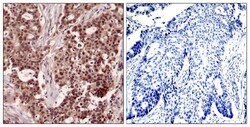 Invitrogen Phospho-NFkB p105 (Ser927) Polyclonal Antibody 100 &mu;L; Unconjugated:Antibodies,