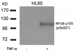 Invitrogen Phospho-NFkB p105 (Ser927) Polyclonal Antibody 100 &mu;L; Unconjugated:Antibodies,