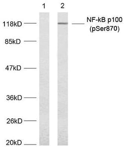 Invitrogen Phospho-NFkB p100 (Ser870) Polyclonal Antibody 100 &mu;L; Unconjugated:Antibodies,