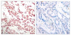 Phospho-NFkB p52 (Ser866) Polyclonal Antibody, Invitrogen 100 &mu;L; Unconjugated:Antibodies,
