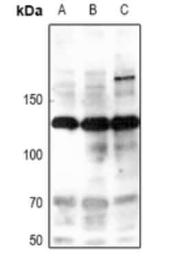 Invitrogen Phospho-iNOS (Tyr151) Polyclonal Antibody 100 &mu;L; Unconjugated:Anticuerpos