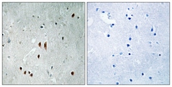 Invitrogen Phospho-CNOT2 (Ser101) Polyclonal Antibody 100 &mu;L; Unconjugated:Antibodies,