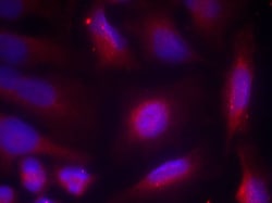 Invitrogen Phospho-TrkA (Tyr791) Polyclonal Antibody 100 &mu;L | Buy Online | Invitrogen&trade; | Fisher Scientific