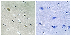 Invitrogen Phospho-PAK1 (Ser204) Polyclonal Antibody 100 &mu;L; Unconjugated:Antibodies,