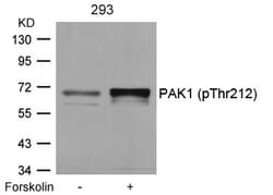 Invitrogen Phospho-PAK1 (Thr212) Polyclonal Antibody 100 &mu;L | Buy Online | Invitrogen&trade; | Fisher Scientific