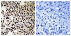 Invitrogen Phospho-PAK2 (Ser197) Polyclonal Antibody 100 μL; Unconjugated:Antibodies,