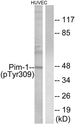 Invitrogen Phospho-PIM1 (Tyr309) Polyclonal Antibody 100 &mu;L; Unconjugated:Anticuerpos