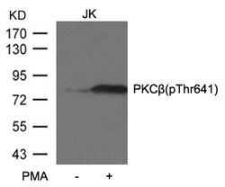 Invitrogen Phospho-PKC beta (Thr641) Polyclonal Antibody 100 &mu;L | Buy Online | Invitrogen&trade; | Fisher Scientific