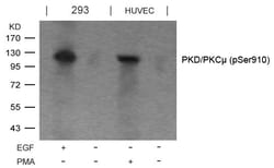 Invitrogen Phospho-PKC mu (Ser910) Polyclonal Antibody 100 &mu;L | Buy Online | Invitrogen&trade; | Fisher Scientific