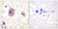 Invitrogen Phospho-PKC mu (Tyr463) Polyclonal Antibody 100 &mu;L; Unconjugated:Antibodies,