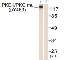 Invitrogen Phospho-PKC mu (Tyr463) Polyclonal Antibody 100 &mu;L | Buy Online | Invitrogen&trade; | Fisher Scientific