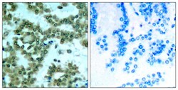 Invitrogen Phospho-PKC theta (Ser676) Polyclonal Antibody 100 &mu;L; Unconjugated:Antibodies,