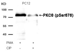 Invitrogen Phospho-PKC theta (Ser676) Polyclonal Antibody 100 &mu;L; Unconjugated:Antibodies,