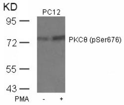 Invitrogen Phospho-PKC theta (Ser676) Polyclonal Antibody 100 &mu;L; Unconjugated:Antibodies,