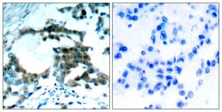 Invitrogen Phospho-PKC theta (Ser695) Polyclonal Antibody 100 &mu;L; Unconjugated:Antibodies,