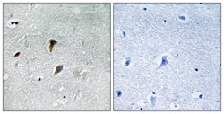 Invitrogen Phospho-MEK3 (Thr222) Polyclonal Antibody 100 &mu;L; Unconjugated:Antibodies,