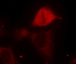 Invitrogen Phospho-MEK3 (Ser189) Polyclonal Antibody 100 &mu;L | Buy Online | Invitrogen&trade; | Fisher Scientific