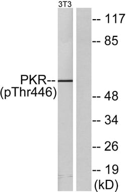 Invitrogen&trade;&nbsp;Phospho-PKR (Thr446) Polyclonal Antibody