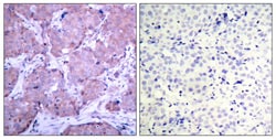 Invitrogen Phospho-PTEN (Ser380) Polyclonal Antibody 100 &mu;L; Unconjugated:Antibodies,