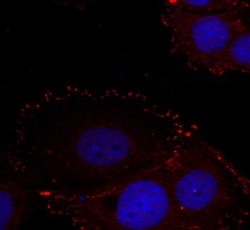 Invitrogen Phospho-FAK (Tyr576, Tyr577) Polyclonal Antibody 100 &mu;L;
