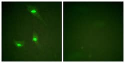 Invitrogen Phospho-RACGAP1 (Ser387) Polyclonal Antibody 100 μL; Unconjugated:Antibodies,