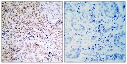 Invitrogen Phospho-Rb (Ser795) Polyclonal Antibody 100 &mu;L; Unconjugated:Antibodies,