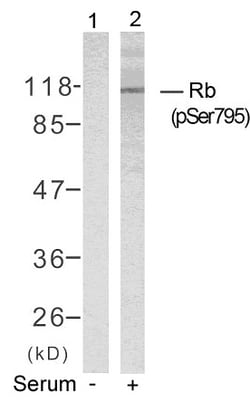 Invitrogen Phospho-Rb (Ser795) Polyclonal Antibody 100 &mu;L; Unconjugated:Antibodies,