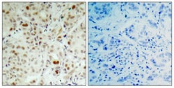 Invitrogen Phospho-Rb (Ser807) Polyclonal Antibody 100 μL; Unconjugated:Antibodies,
